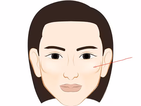  Cái gọi là trán và gò má chỉ bốn góc trên khuôn mặt của chúng ta. Bao gồm phần trán bên trái và bên phải, phần bên trái và bên phải của má. Vì nằm ở bốn phía má nên còn gọi là trấn biên giới. Bốn bộ phận này tròn trịa và nhô ra, cộng với đôi mắt sáng và đôi tai cao hơn lông mày, đây là điều kiện để rồng xuất hiện.