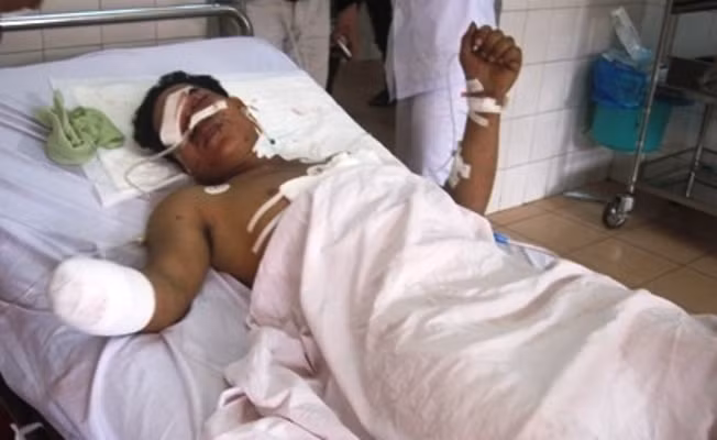 Nạn nhân Đinh Âng tại bệnh viện
