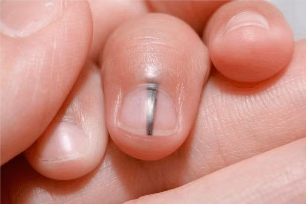 6 dau hieu canh bao som, can di tam soat ung thu