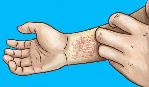 8 dau hieu som cho thay than cua ban khong hoat dong binh thuong-Hinh-3