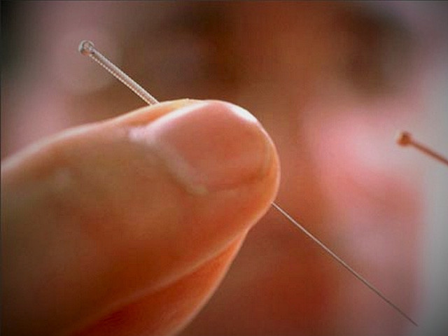 Kim cham thu doc trong gioi giang ho co thu duoc bach doc?