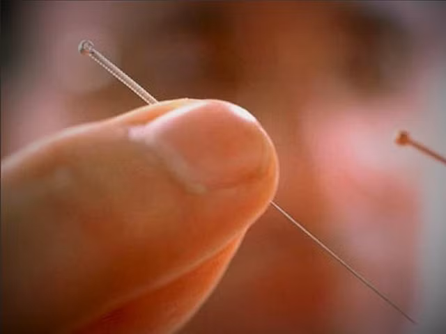 Kim cham thu doc trong gioi giang ho co thu duoc bach doc?