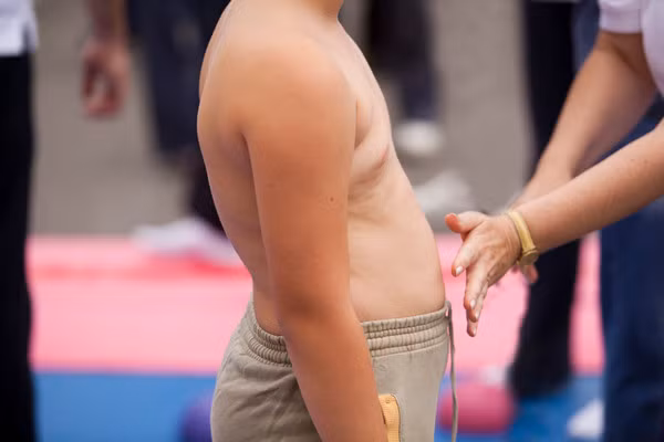 Be trai 12 tuoi nang 80kg, bac si choang vi thuc don 