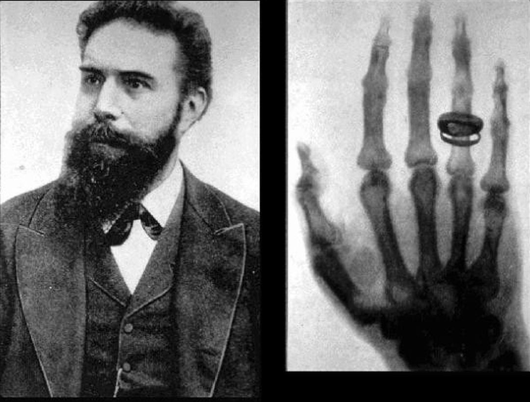 Ngày nay, công nghệ tia X được sử dụng rộng rãi trong y học, phân tích vật liệu và các thiết bị như máy quét an ninh sân bay.