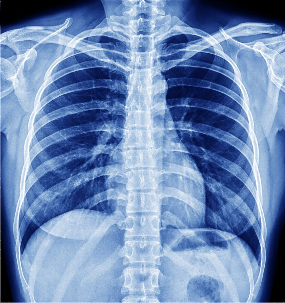 Trên phương diện vật lý học, tia X hay tia Rontgen là sóng năng lượng điện từ hoạt động tương tự như tia sáng thông thường, nhưng ở bước sóng ngắn hơn khoảng 1.000 lần.