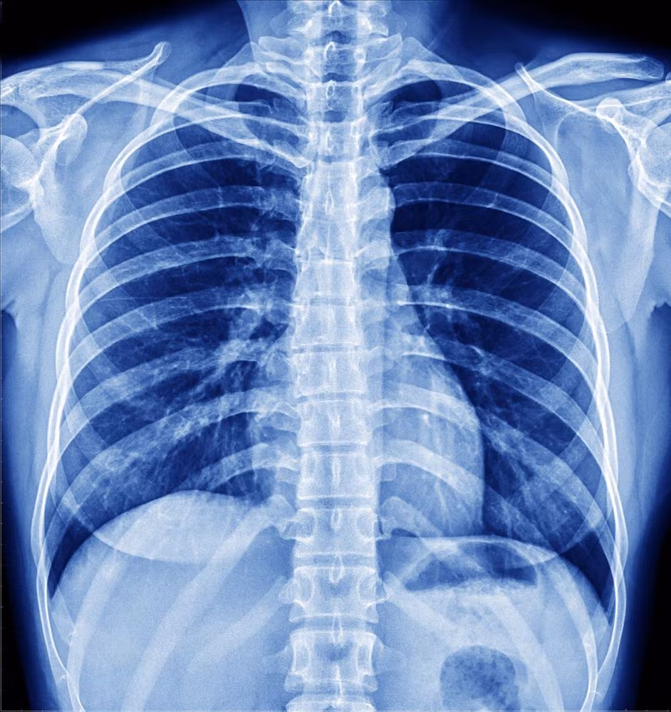 Trên phương diện vật lý học, tia X hay tia Rontgen là sóng năng lượng điện từ hoạt động tương tự như tia sáng thông thường, nhưng ở bước sóng ngắn hơn khoảng 1.000 lần.