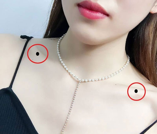 Nốt ruồi ở xương đòn. Phụ nữ có nốt ruồi trên xương đòn là người sống nặng tình, biết quan tâm đến người khác. Họ là những người có trái tim nhân hậu, tấm lòng bao dung. 