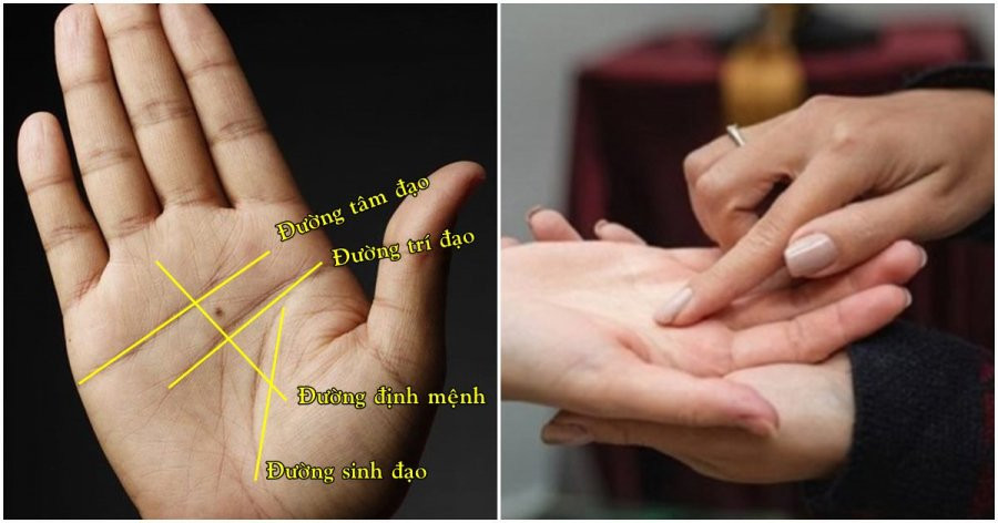 6 nốt ruồi ở tay phá tài phá lộc, tình tiền khốn khó - Hình 2 6 not ruoi o tay pha tai pha loc, tinh tien khon kho-Hinh-2