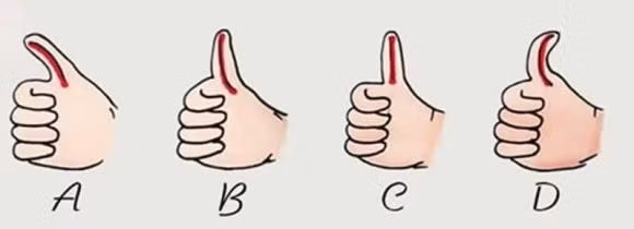 Ban tay nhu the nao phu thuoc vao viec ban giau hay ngheo