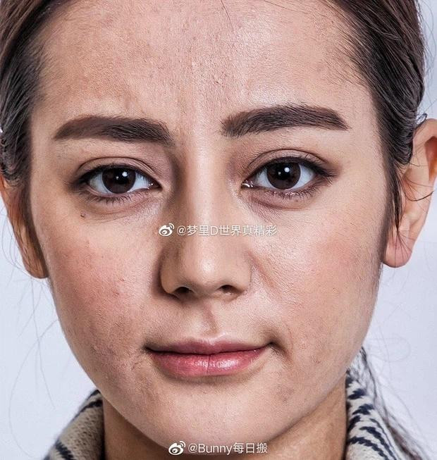 br/> Nhắc đến một trong những mỹ nhân Tân Cương đình đám không thể không kể tên Địch Lệ Nhiệt Ba. Người đẹp sở hữu nhan sắc hơn người, luôn đứng top trong các bảng xếp hạng mỹ nhân sở hữu nhan visual cực phẩm. Thế nhưng, có vẻ như nhan sắc của nàng tiểu Hoa đán cũng không thể đối đầu được với thời gian. Và khi chút bỏ lớp phấn son hay photoshop, Địch Lệ Nhiệt Ba còn lại gì? Cận cảnh gương mặt rõ đến từng lỗ chân lông, khuyết điểm vết thâm mụn và nếp nhăn của Địch Lệ Nhiệt Ba.