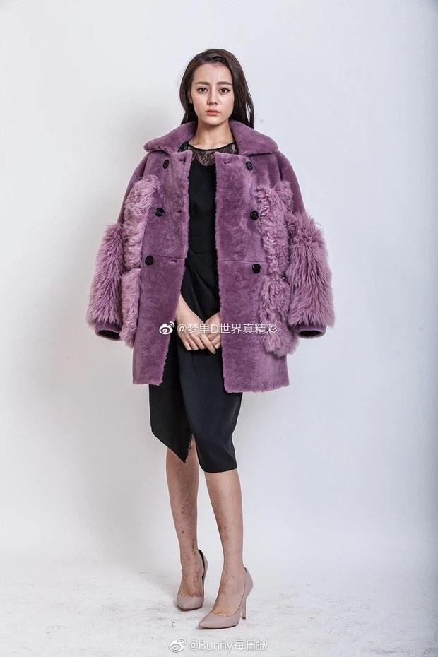 Không chỉ gương mặt mà ngay cả đôi chân của cô cũng bị soi đầy "hoa gấm".