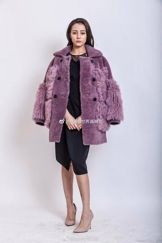 Không chỉ gương mặt mà ngay cả đôi chân của cô cũng bị soi đầy "hoa gấm".