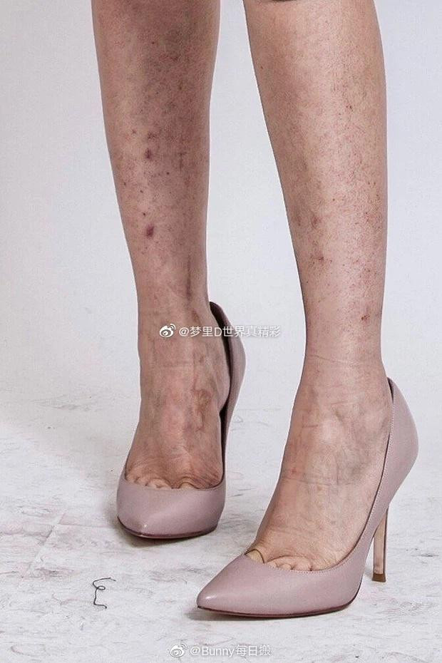 Cận cảnh đôi chân đầy khuyết điểm của mỹ nhân đứng top Trung Quốc. Rất nhiều những vết thâm, sứt sẹo nổi rõ trên da Nhiệt Ba khiến netizen ngỡ ngàng.