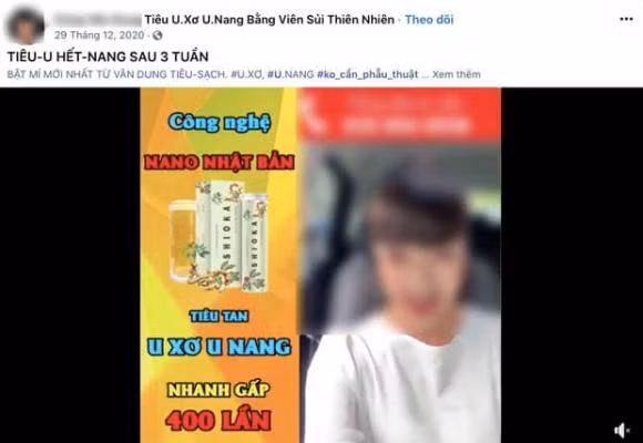 Van Dung bi VTV24 dua tin quang cao san pham sai su that?