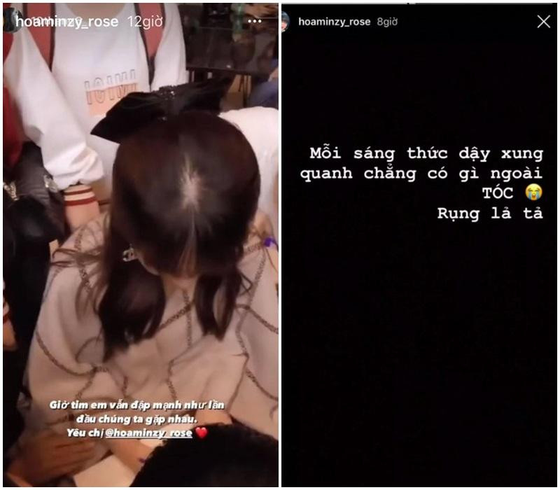 Ảnh trái cho thấy nỗi niềm bao năm qua của ca sĩ Hòa Minzy là thật khi phải chịu cảnh tóc rụng từng mảng đến lộ cả da đầu, và cho đến hiện tại vẫn chưa có dấu hiệu cải thiện. Cô nàng từng than thở về chuyện tóc tai của mình: "Mỗi sáng thức dậy xung quanh toàn tóc, rụng lả tả"