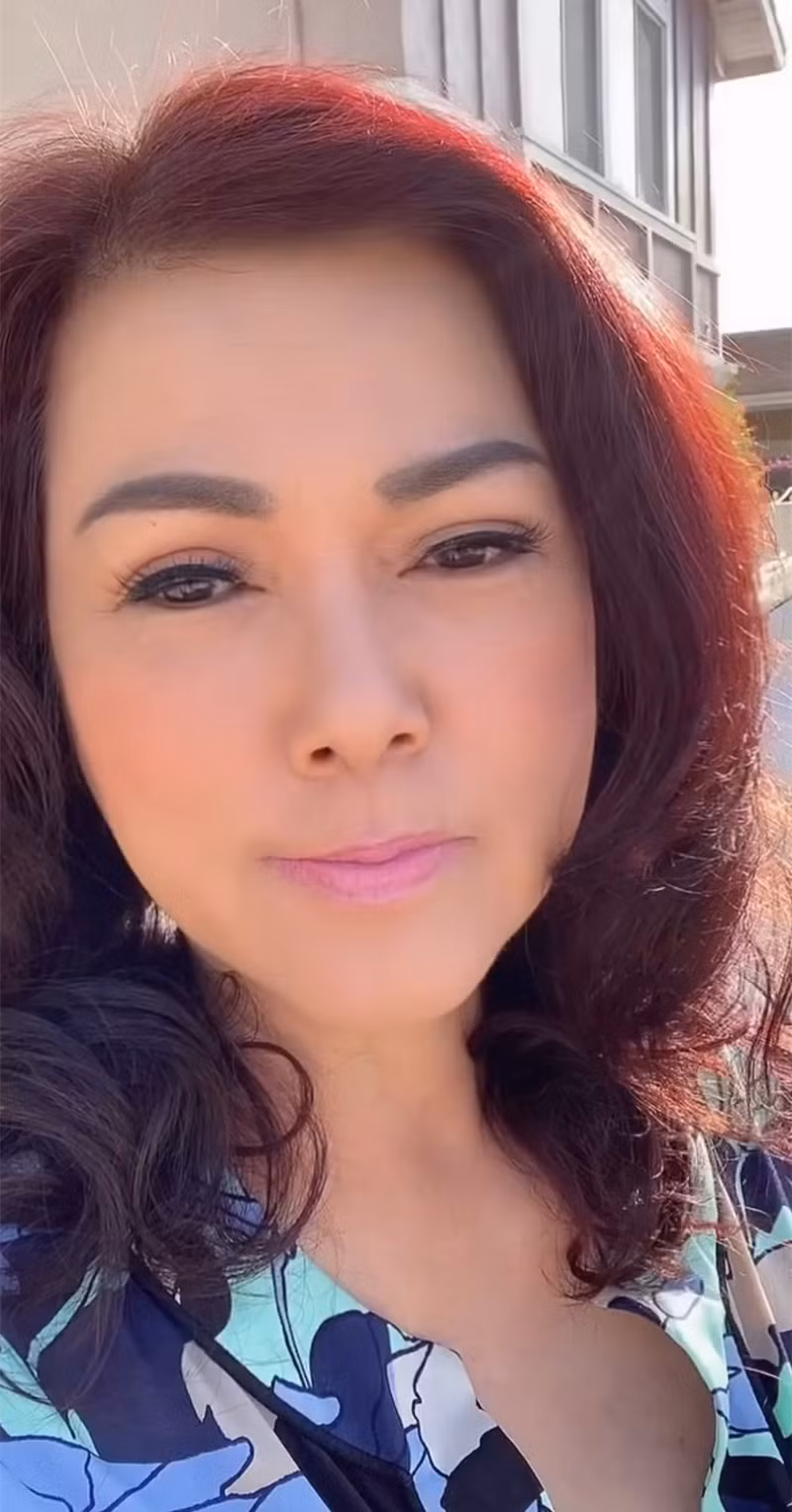 Ca sĩ Phương Loan trấn an người hâm mộ về chấn thương ở tay. Hiện tại, tay cô vẫn còn đau, không thể làm việc nặng nhưng không nghiêm trọng, có thể đi làm hằng ngày.