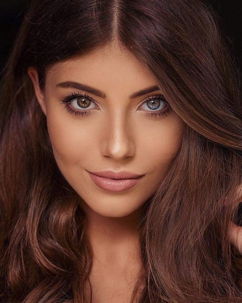 ôi mắt 2 màu giúp Natalia Gryglewska trở thành hoa hậu đặc biệt trên thế giới.