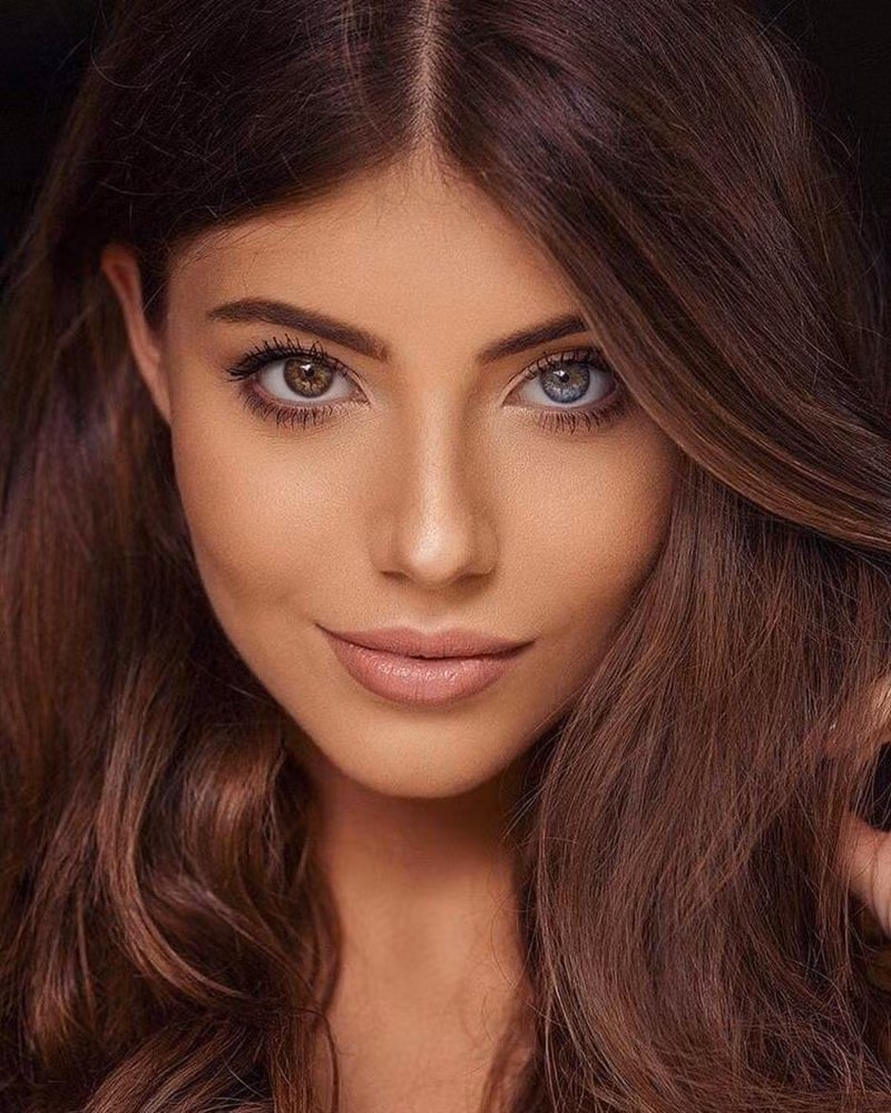 Đôi mắt 2 màu giúp Natalia Gryglewska trở thành hoa hậu đặc biệt trên thế giới.