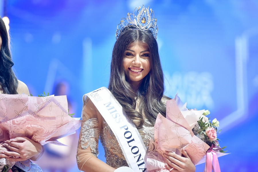 Ảnh nóng rực của hoa hậu có đôi mắt mang 2 màu khác biệt Anh nong ruc cua hoa hau co doi mat mang 2 mau khac biet