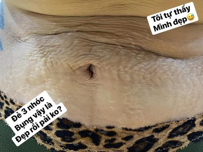 Vậy nhưng Hải Băng cũng chẳng thể thoát khỏi “lời nguyền” của những vết rạn. Cô tự tin khoe lên trang cá nhân bức ảnh vòng 2 bèo nhèo, chằng chịt nếp nhăn khiến người xem "rùng mình". Hải Băng bộc bạch rằng cô xác định mang thai là cơ thể không còn được như thời con gái, nhưng để con cái được phát triển đầy đủ, khỏe mạnh thì cô chấp nhận chịu xấu. 