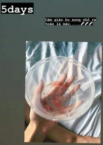 Kha Ngan noi gi ve loat anh 