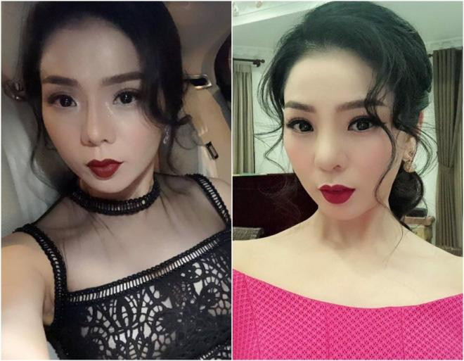 Công khai sửa mũi từ rất lâu rồi nhưng ca sĩ Lệ Quyên từng gặp hiện tượng mũi sưng to, hơi lệch về một phía. Đại diện của cô chia sẻ: "Chị Lệ Quyên sửa mũi từ chục năm nay. Nhưng gần đây, mũi của chị bị sưng rất nặng. Lúc đầu chị còn nghĩ không sao, uống thuốc sẽ khỏi nhưng không phải".