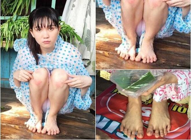 Đóng góp vào bộ sưu tập nhược điểm không thể sửa tiếp theo của Ngọc Trinh là đôi chân. Nhiều lần mẫu nội y bị chê bàn chân xương xẩu.
