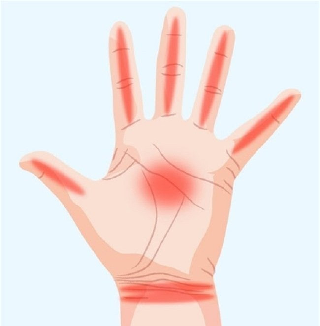 Dau hieu ban tay canh bao can benh nguy hiem dung dai bo qua-Hinh-2