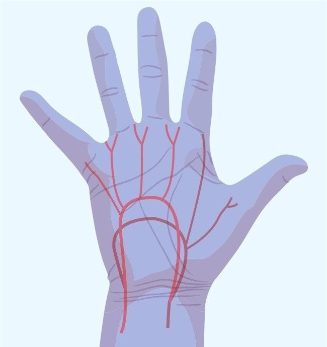 Dau hieu ban tay canh bao can benh nguy hiem dung dai bo qua