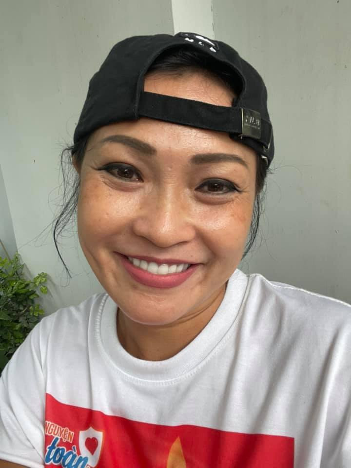 Phương Thanh bị nám đen sau 3 tháng làm tình nguyện viên chống dịch.