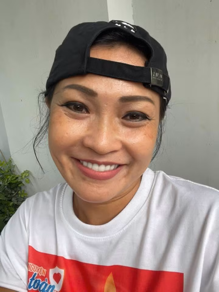 Phương Thanh bị nám đen sau 3 tháng làm tình nguyện viên chống dịch.