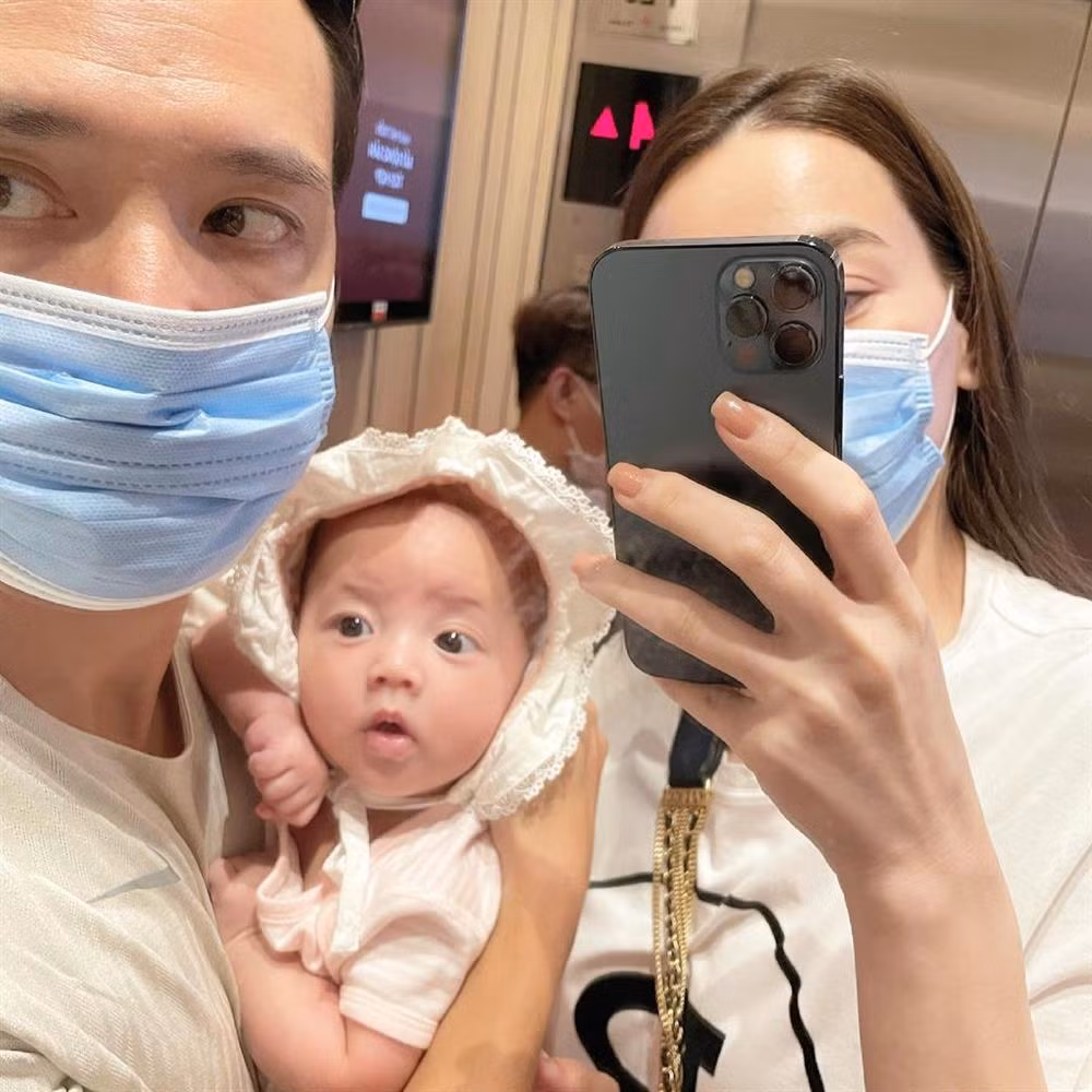 Những nếp nhăn trên trán nam diễn viên 38 tuổi.