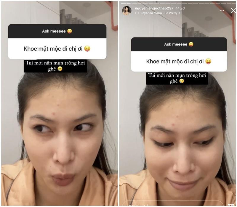 Có thể thấy làn da không đều màu, quầng thâm mắt lộ rõ của cô nàng, đặc biệt là phần trán chi chít mụn. Việc không thoa son cộng với độ chân thật từ camera thường khiến đôi môi kém hồng hào của nàng Hậu cũng bị phơi bày trước ống kính.