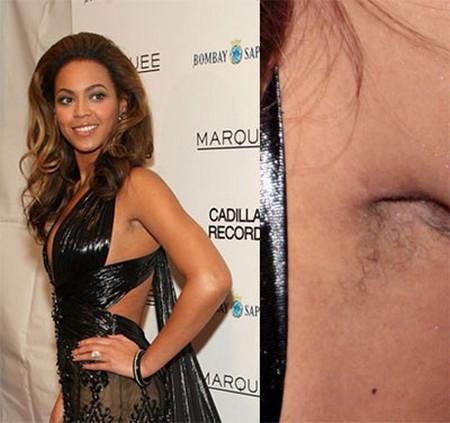 ình ảnh kém đẹp này cũng xảy ra ở nữ ca sĩ nổi tiếng Beyoncé.