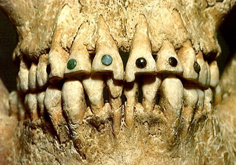  9. Kỹ thuật nha khoa. Người Maya gắn các viên đá quý như ngọc bích vào răng của họ vì lý do thẩm mỹ và tôn giáo, bằng một kỹ thuật nha khoa phức tạp. Ảnh: Archaeology Now.