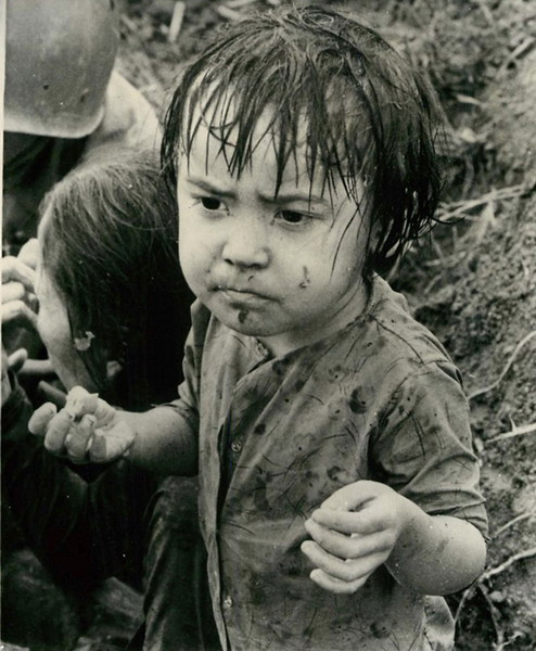 Be gái bị thương do chiến sự và đang chờ được chăm sóc y tế ở Hiệp Đức, Quảng Nam, ngày 21/11/1965.