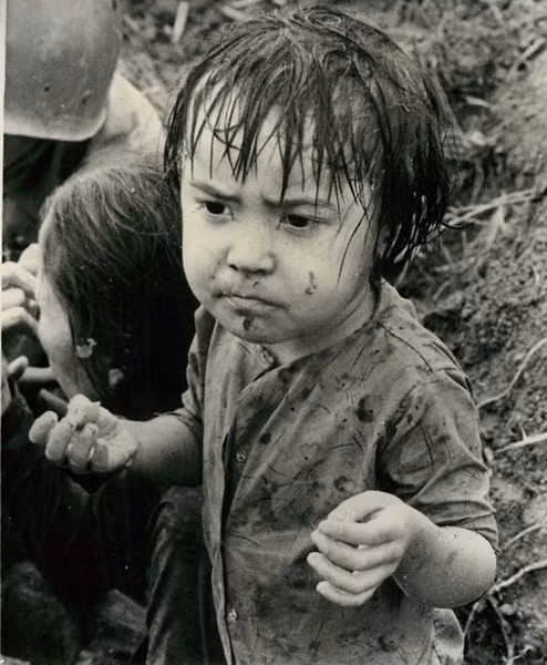 Be gái bị thương do chiến sự và đang chờ được chăm sóc y tế ở Hiệp Đức, Quảng Nam, ngày 21/11/1965.