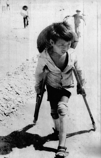 Với 2 chân bằng gỗ, em bé này đang di tản khỏi vùng chiến sự ở Thủ Đức, 2/8/1974.