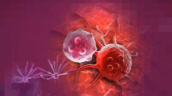 Xuat hien 3 'tinh huong' nay khi dai tien buoi sang, coi chung ung thu