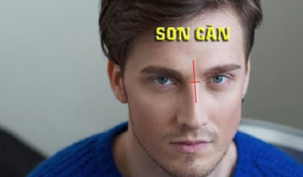 Sơn Căn đứt đoạn, sống mũi xiên vẹo. Sơn Căn là vị trí ở giữa hai phần mắt, vùng dưới Ấn Đường (khoảng cách giữa hai mắt) và là nơi cao nhất trên sống mũi.