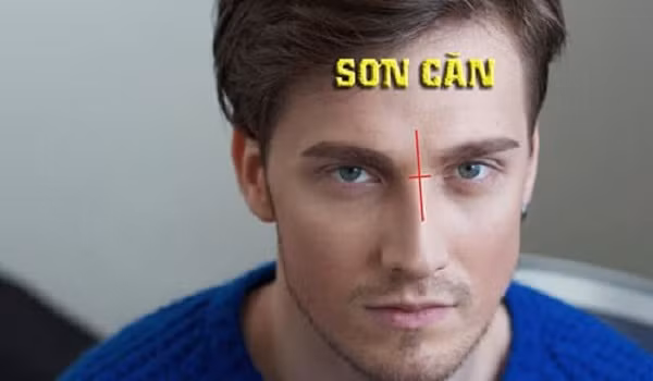 Sơn Căn đứt đoạn, sống mũi xiên vẹo. Sơn Căn là vị trí ở giữa hai phần mắt, vùng dưới Ấn Đường (khoảng cách giữa hai mắt) và là nơi cao nhất trên sống mũi.