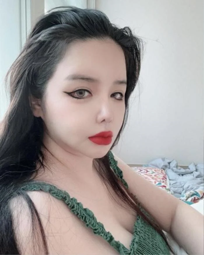 Park Bom hỏng nhan sắc vì nghiện phẫu thuật thẩm mỹ - Hình 2 Park Bom hong nhan sac vi nghien phau thuat tham my-Hinh-2