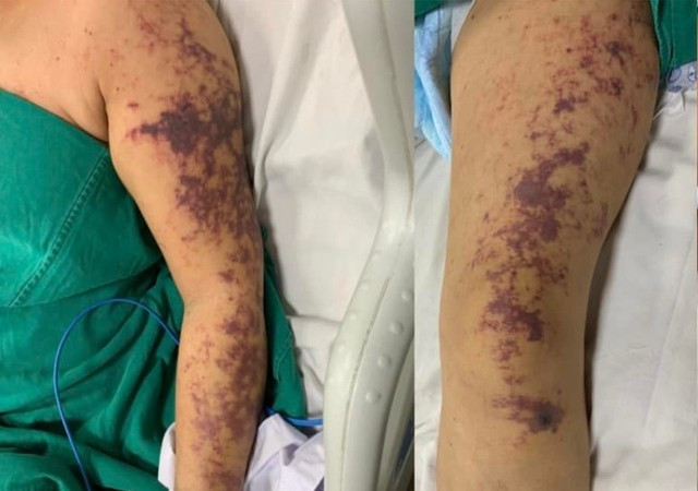 4 nhóm người đại kỵ với lòng lợn, ăn vào bệnh sẽ trầm trọng hơn 4 nhom nguoi dai ky voi long lon, an vao benh se tram trong hon