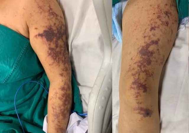 4 nhóm người đại kỵ với lòng lợn, ăn vào bệnh sẽ trầm trọng hơn 4 nhom nguoi dai ky voi long lon, an vao benh se tram trong hon