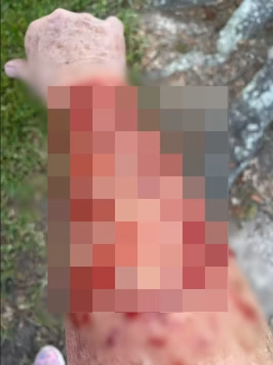 Ran tu tren cao roi trung nguoi, roi dieu hau lao xuong tan cong-Hinh-2