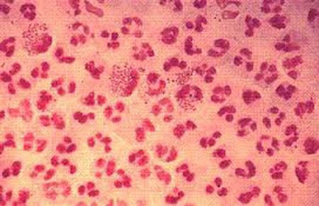 Khi nhiễm các bệnh lây truyền qua đường tình dục. Mọi hành vi tình dục có liên quan với các chất dịch cơ thể của người khác cần phải rất cẩn thận vì nó có chứa một số nguy cơ lây truyền các bệnh qua đường tình dục. Khi đã chắc chắn mình mắc bệnh lây truyền qua đường tình dục thì tuyệt đối kiêng “chuyện ấy” và chữa trị dứt điểm.