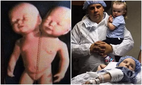 Ngoài Asa và Eli, cặp vợ chồng 34 tuổi Robin và Michael trước đó đã có một bé gái 22 tháng tuổi có tên Selah.