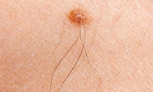 Loại nhang này thường được ngâm tẩm các loại hóa chất công nghiệp để tạo mùi hương chứ không phải được tạo ra từ hương tự nhiên. Chính vì vậy, những hóa chất có trong các loại nhang này sẽ gây ra những ảnh hưởng không nhỏ tới sức khỏe của người sử dụng như dị ứng, nhiễm trùng, thậm chí hoại tử.