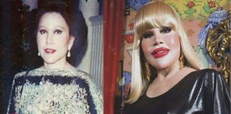 Và rồi, sau khi thẩm mỹ, khuôn mặt của cô khiến người nhìn phải giật mình