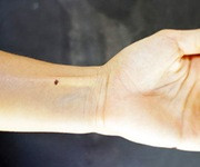 6. Nốt ruồi ở cổ tay. Theo các nhà nghiên cứu, những người có nốt ruồi ở tay là những người có khả năng thiên bẩm, họ khá thông minh và nhanh nhẹn. Họ có khả năng nắm bắt những điều liên quan tới các lĩnh vực chuyên môn khá nhanh nhạy. Con đường sự nghiệp của nhóm người này cũng có xu hướng thẳng tiến đều đều theo thời gian. Đặc biệt, thời điểm rực rỡ nhất của họ được xác định là khi họ bước qua tuổi 35.